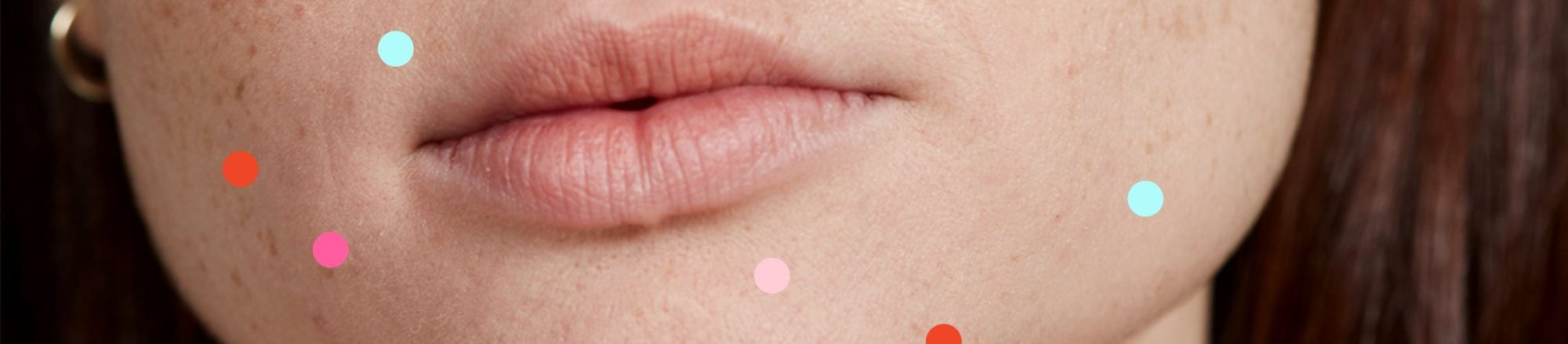 vị trí mụn trên khuôn mặt