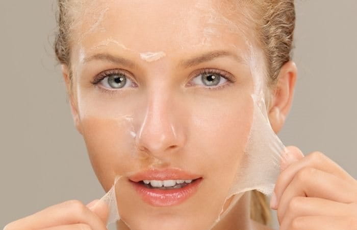 Lợi Ích Của Peel Da Mặt