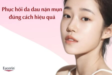 Phục hồi da sau nặn mụn đúng cách hiệu quả nhất