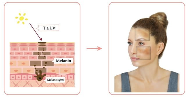 Tia UV tác động đến việc sản xuất melanin