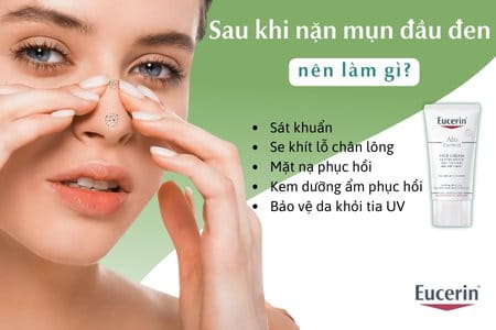 Sau khi nặn mụn đầu đen nên làm gì để không thâm sẹo
