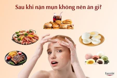 Sau khi nặn mụn không nên ăn gì để tránh sẹo thâm