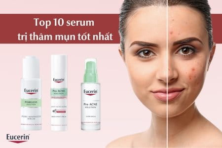 serum trị thâm mụn