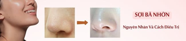 sợi bã nhờn là gì