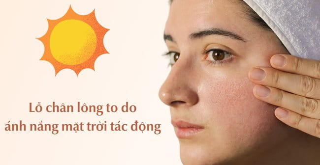 Lỗ chân lông to do ánh nắng mặt trời