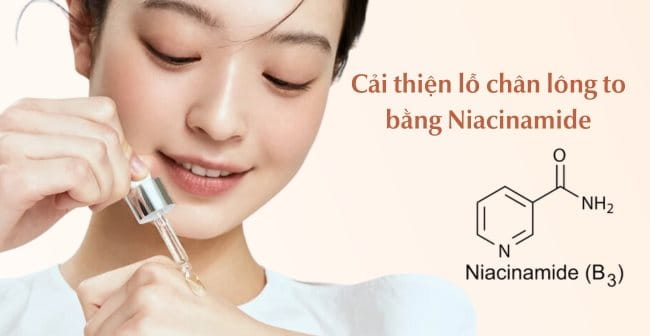 Cải thiện lỗ chân lông to bằng Niacinamide