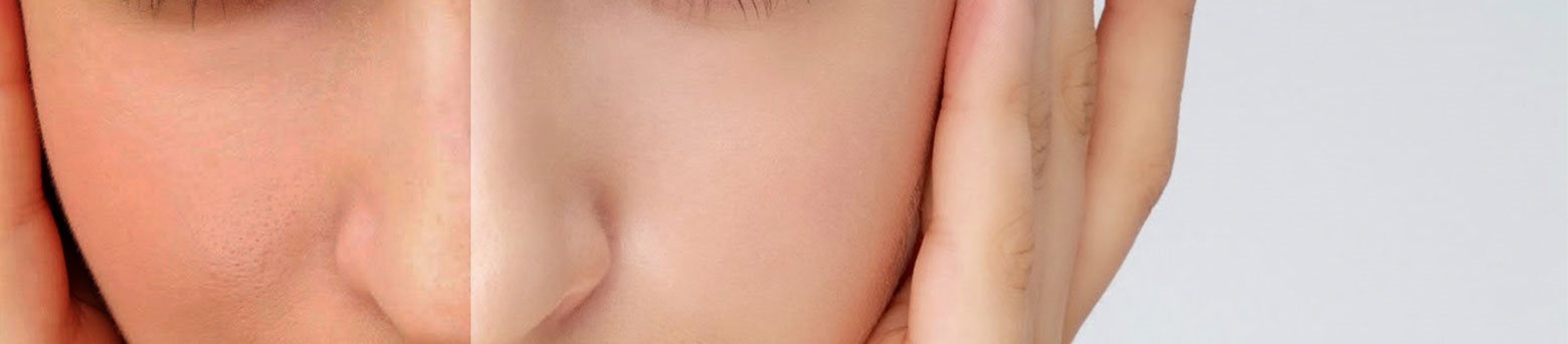 kem dưỡng trắng da mặt cho da dầu