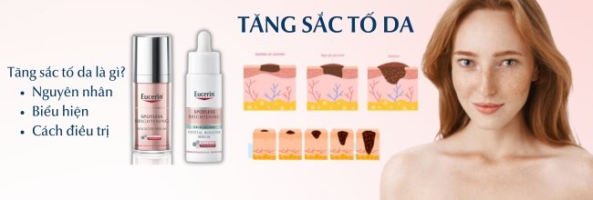Tăng sắc tố da là gì? Nguyên nhân, biểu hiện và cách trị