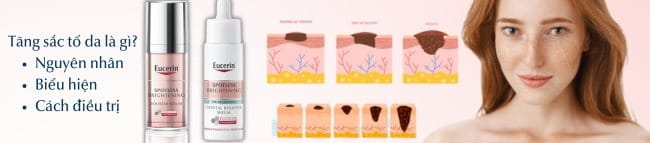 Tăng sắc tố da là gì? Nguyên nhân, biểu hiện và cách trị