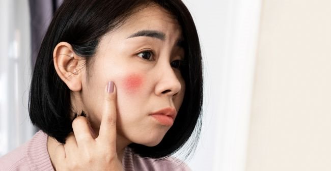 Điều trị các bệnh lý về da để cải thiện tình trạng tăng sắc tố