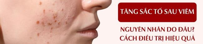 Tăng sắc tố sau viêm