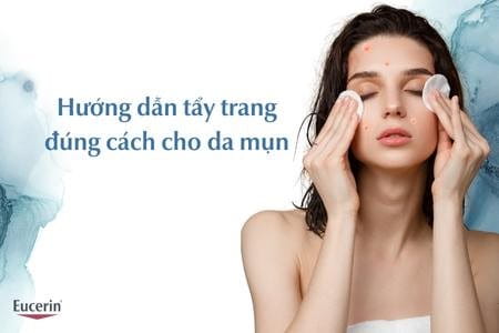 Tẩy trang đúng cách cho da mụn hiệu quả