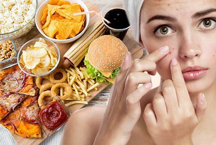 thói quen xấu gây mụn