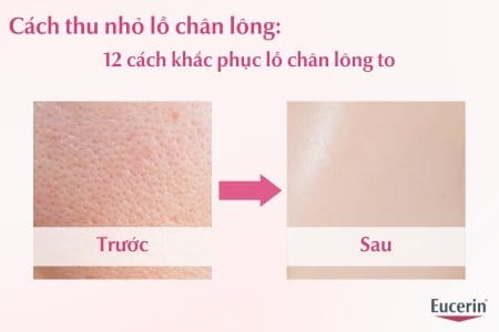 Cách thu nhỏ lỗ chân lông