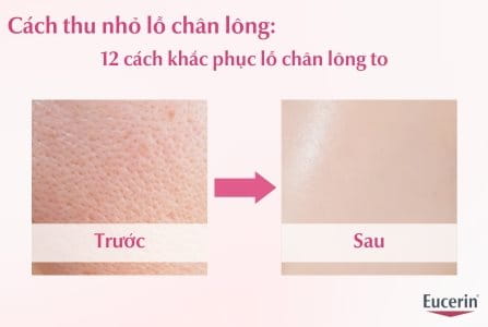 Cách thu nhỏ lỗ chân lông