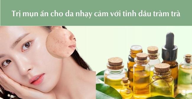 Sử dụng tinh dầu ràm trà là cách trị mụn ẩn cho da nhạy cảm lành tính