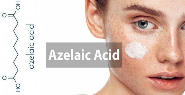 Trị mụn đầu đen với Azelaic Acid