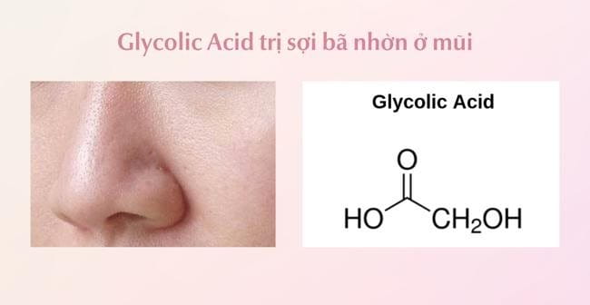 Glycolic Acid trị sợi bã nhờn ở mũi