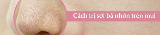 Cách trị sợi bã nhờn trên mũi an toàn, hiệu quả