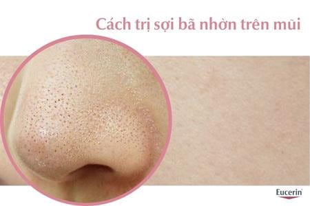 Cách trị sợi bã nhờn trên mũi an toàn