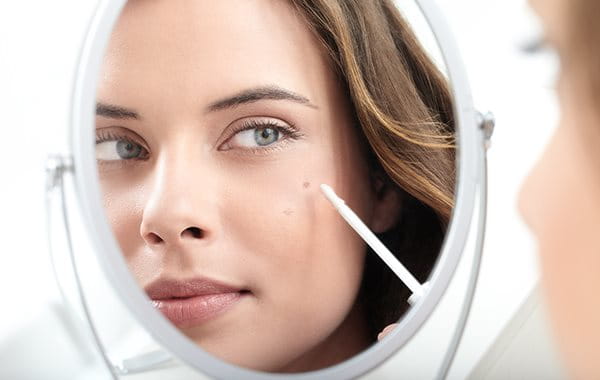 brightening creams for acne