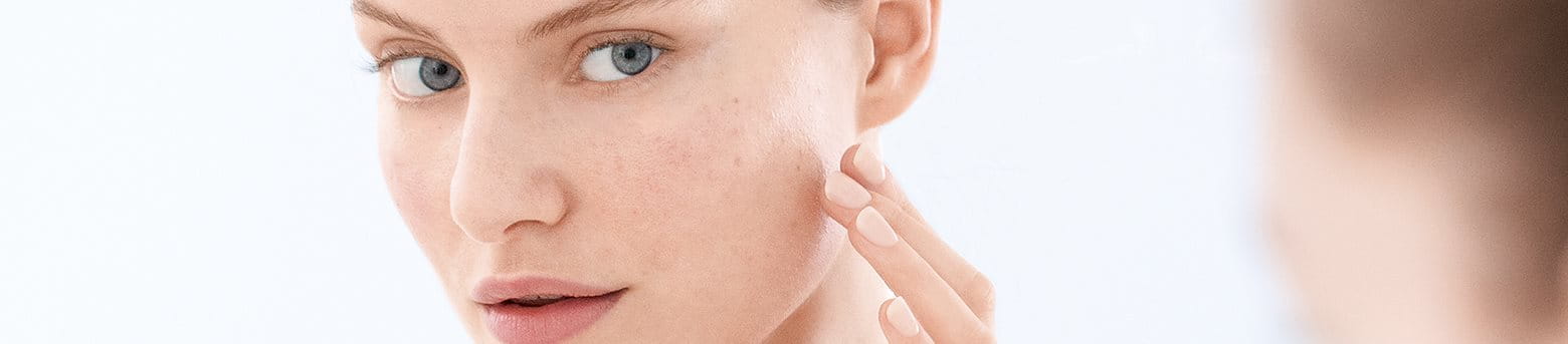 Woman with blemished skin