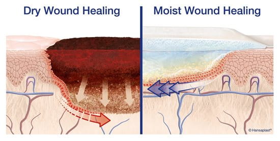 Elastoplast fast healing