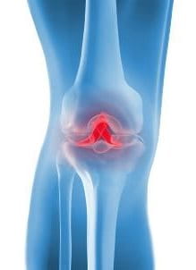 photo d'un genou vu de l'intérieur où le point douloureux est marqué en rouge