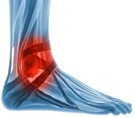 Broken ankle recovery guide