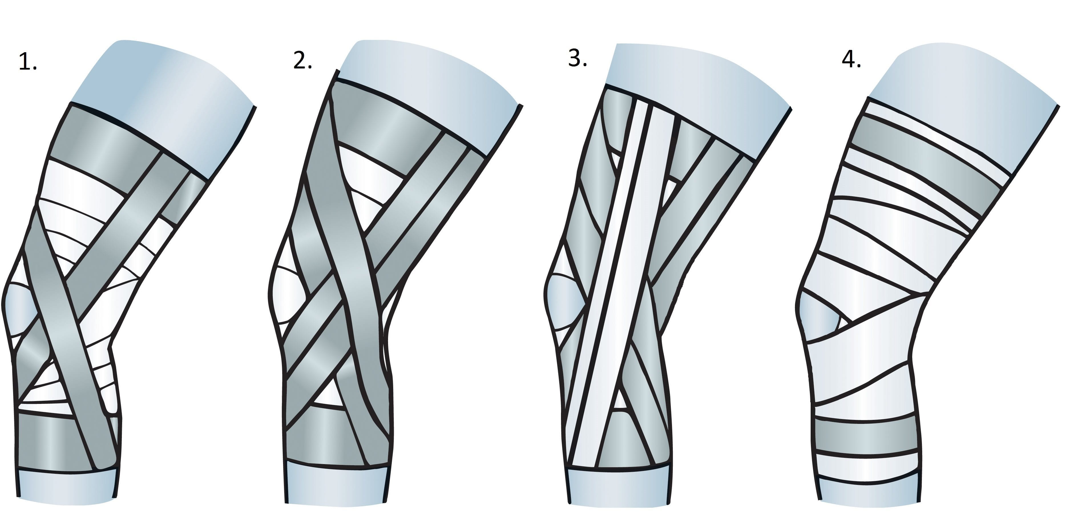 Knee strapping shop