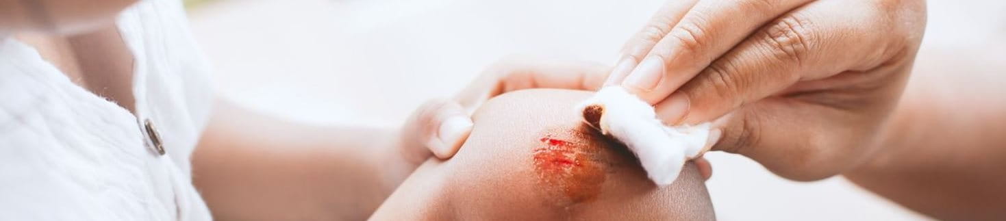 Wundarten wie Schüfwunden am Knie erkennen und richtig behandeln