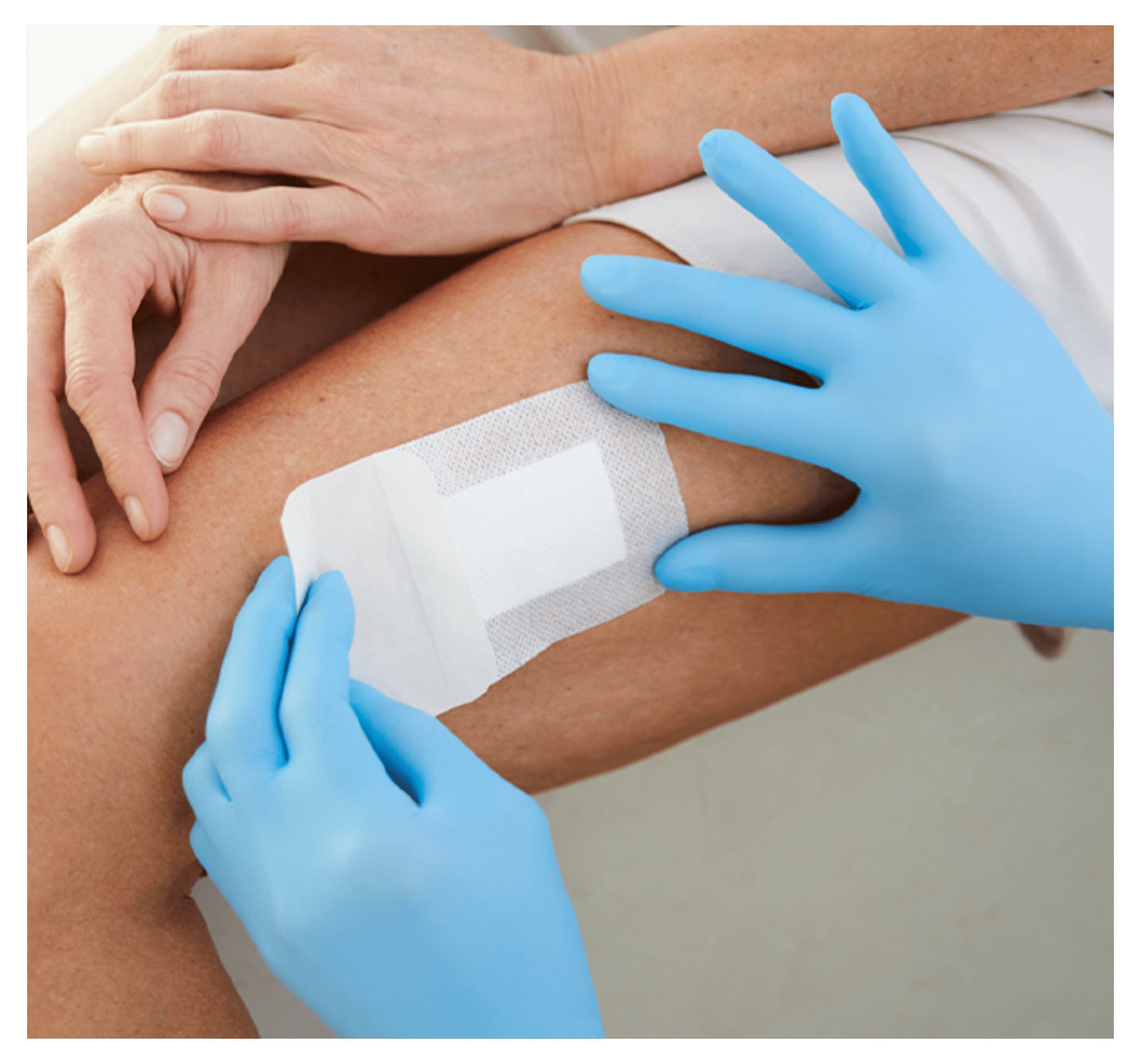 Doctor applying a dressing to a person's leg