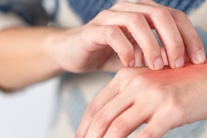 a person scratching she/he infected hand