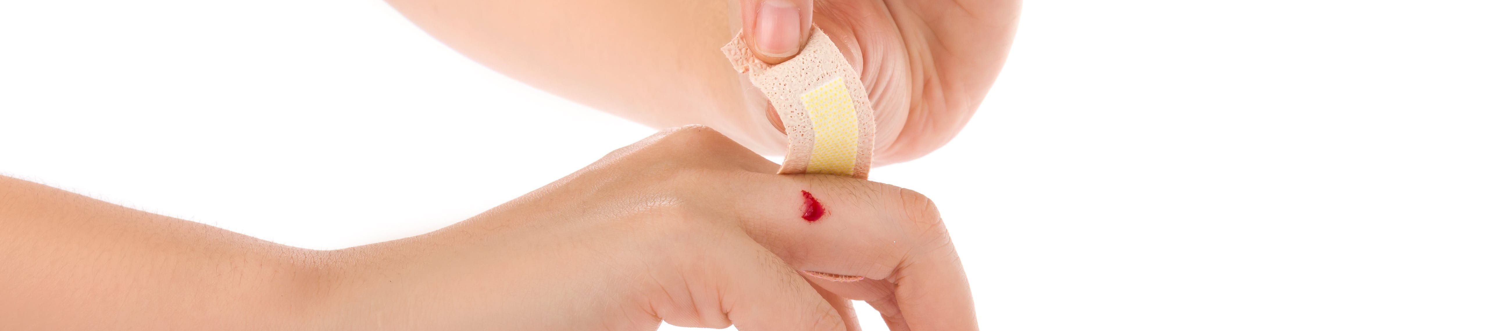 Perawatan luka terbuka agar tidak semakin parah.