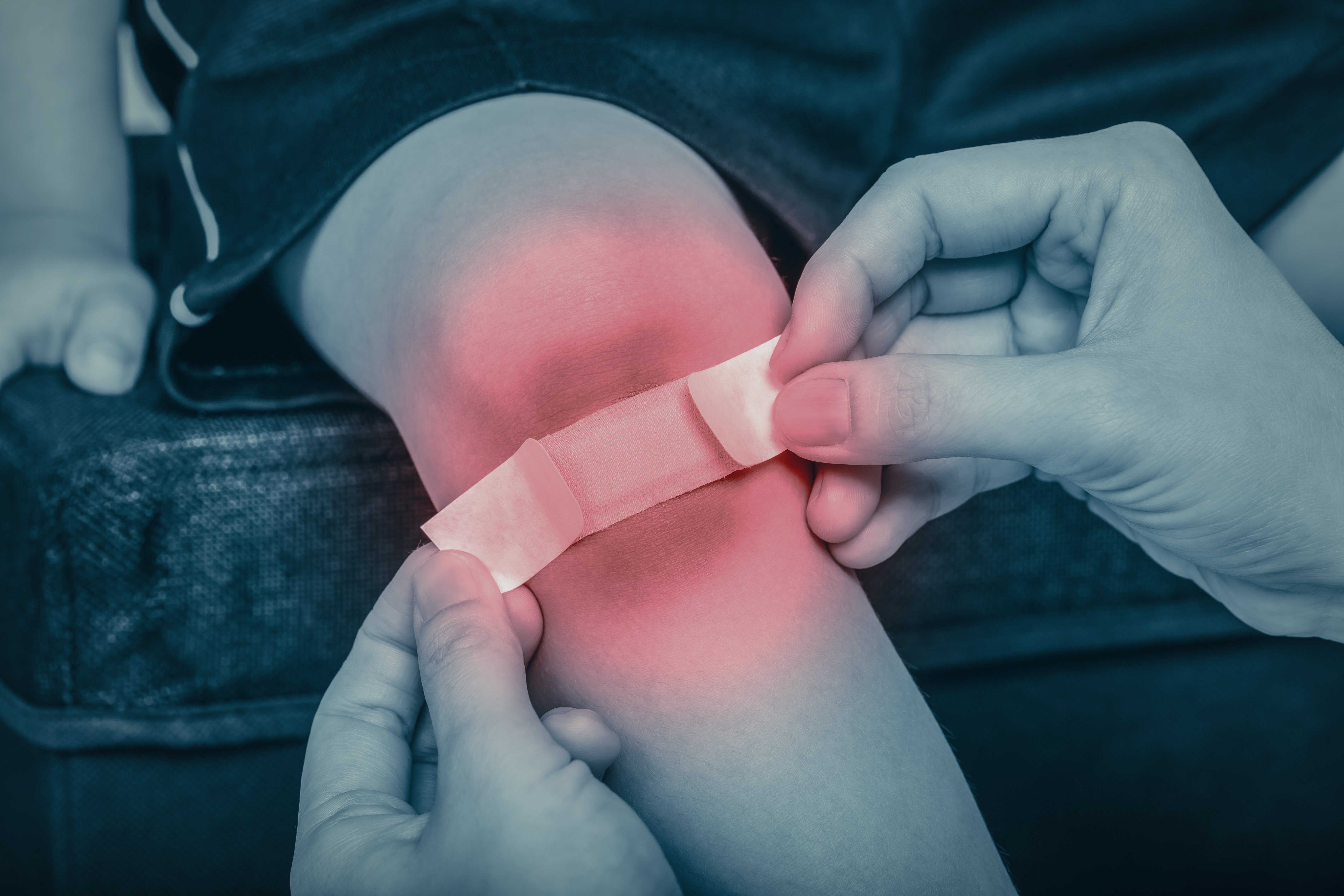 Cara mengobati luka goresan pada anak.