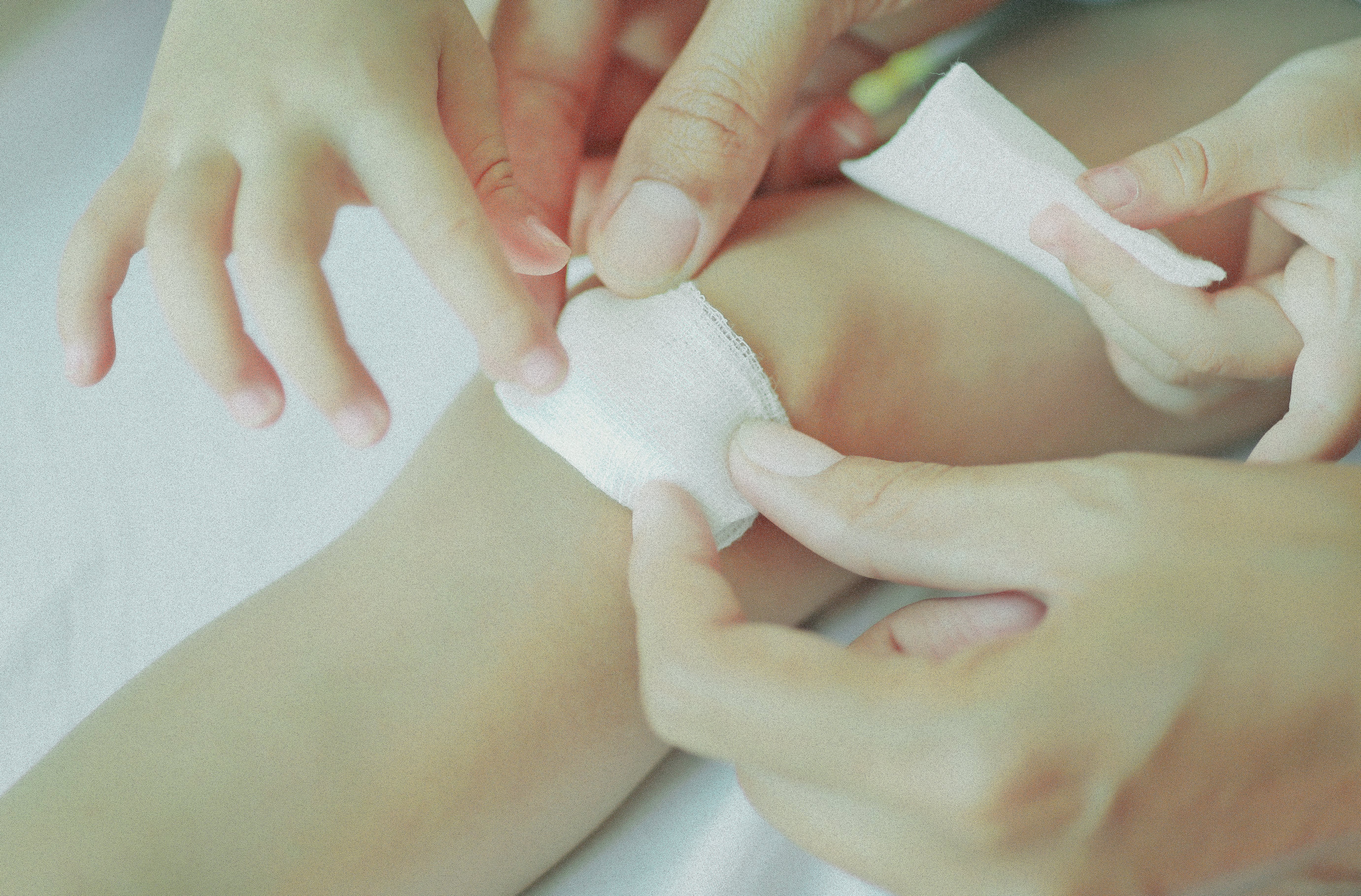 Cara mengobati luka goresan di kaki