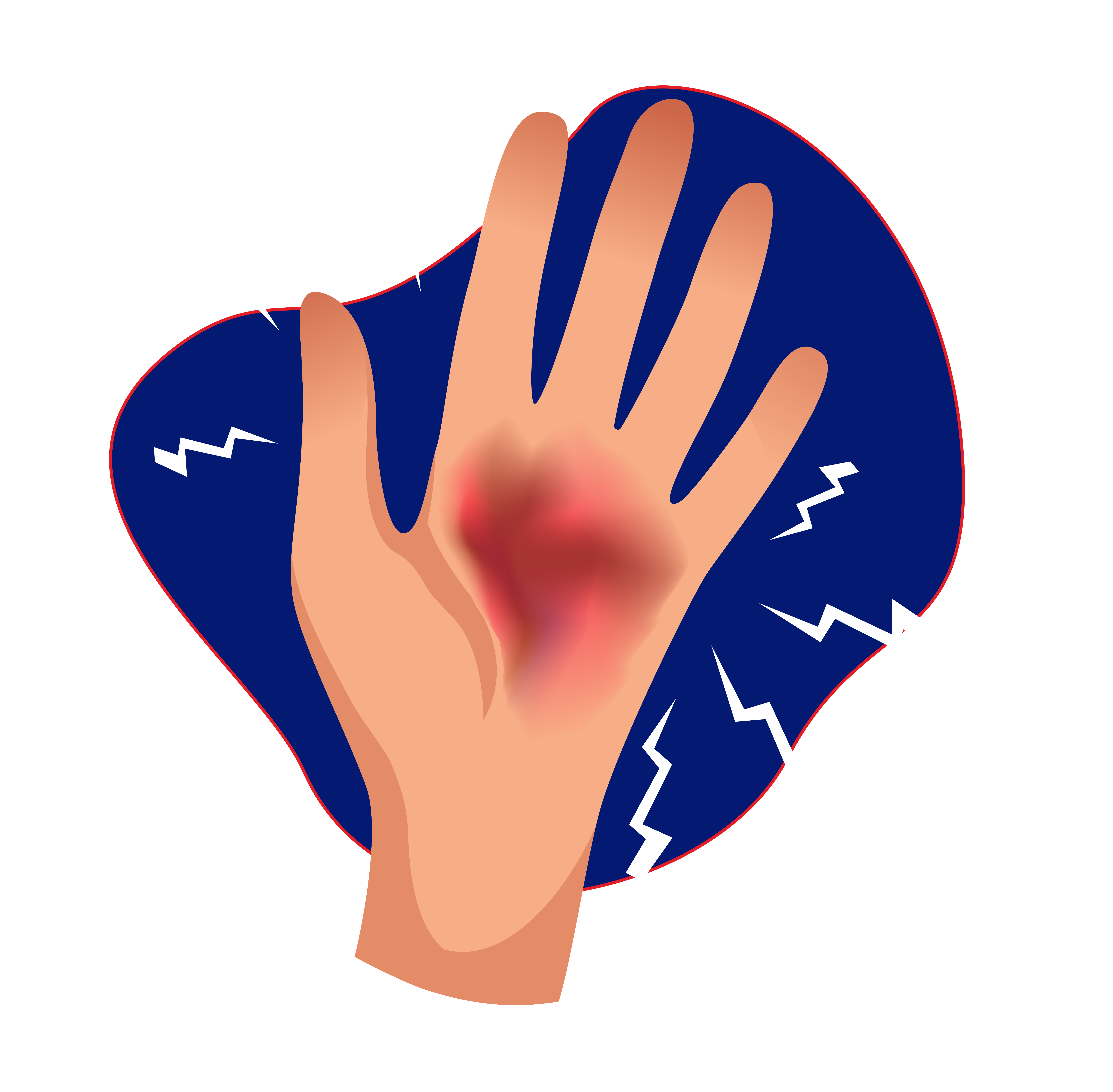 Tanda-tanda infeksi yang memerah