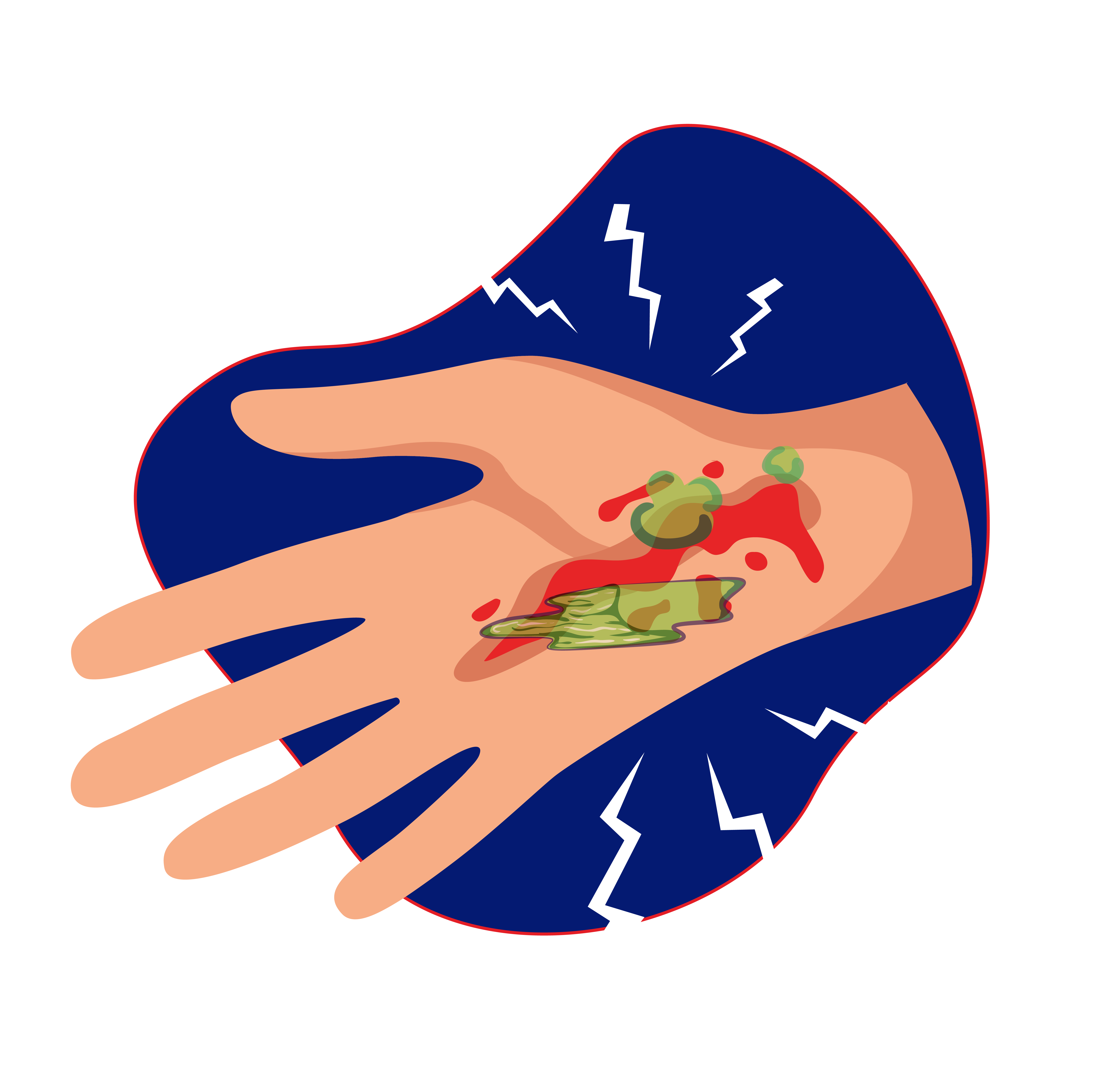 Luka bernanah adalah tanda-tanda infeksi