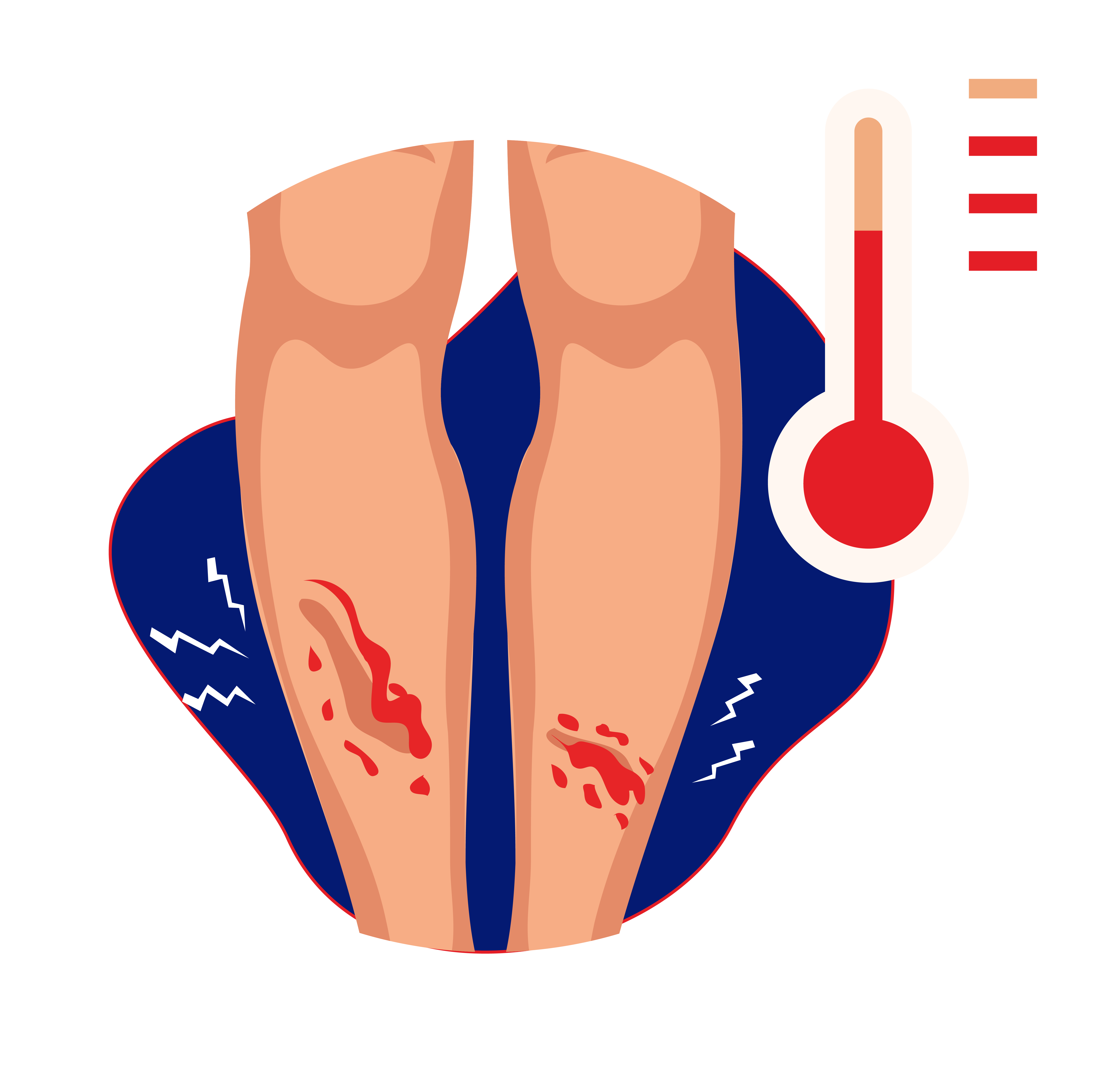 Tanda-tanda infeksi berupa demam
