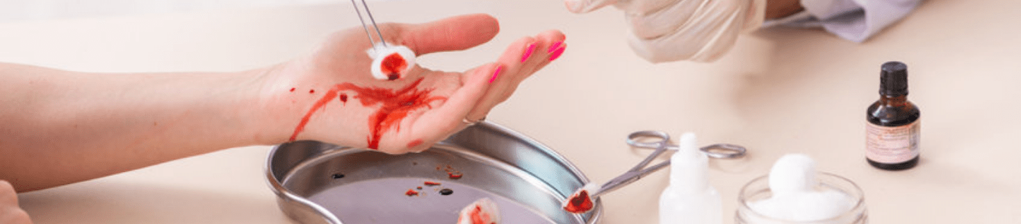 Perawatan luka terbuka sangat penting diketahui.