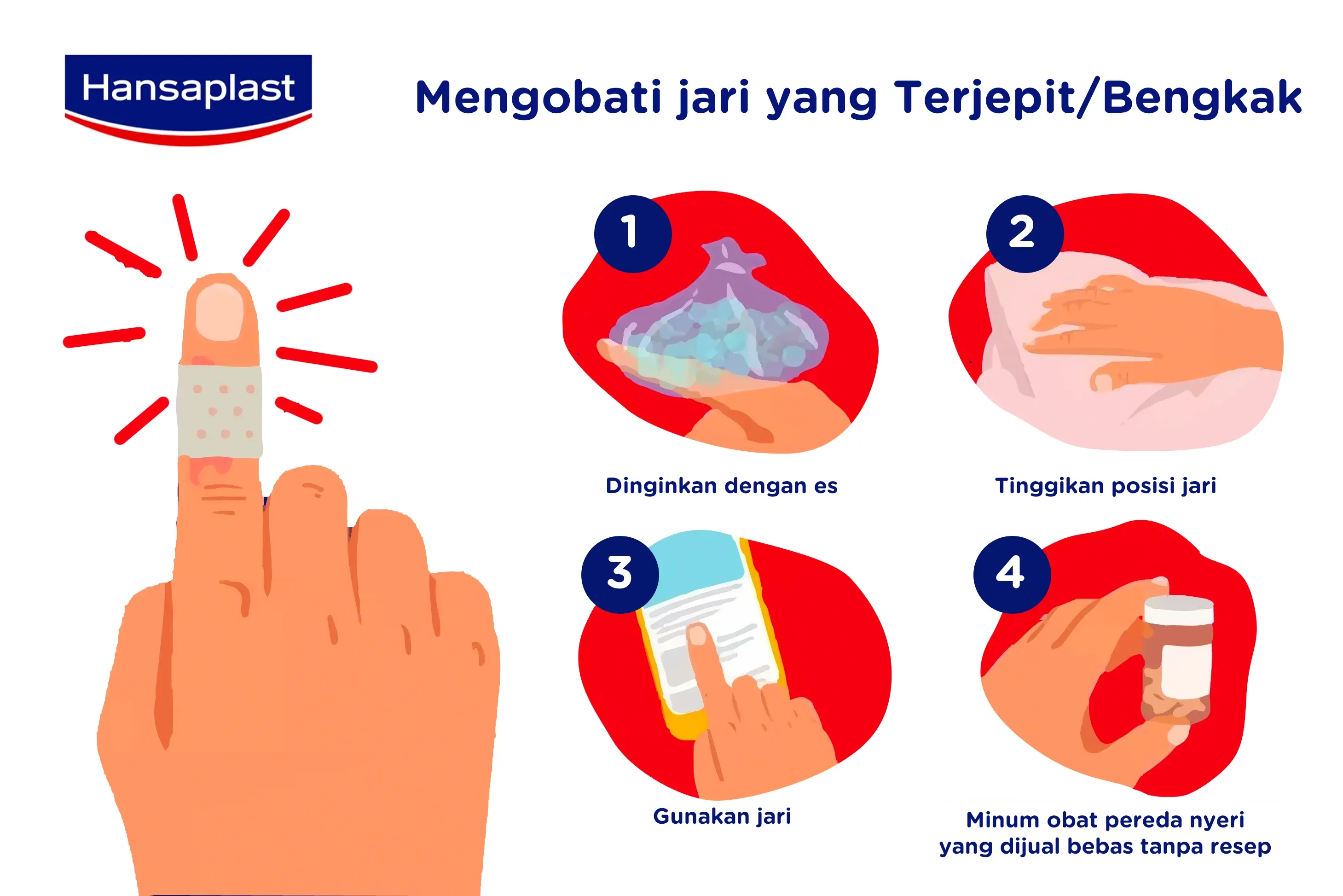 Langkah mengobati jari kejepit pintu agar tidak semakin parah.