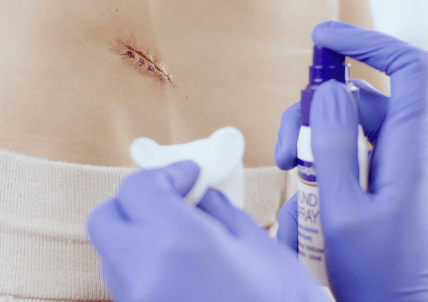 Spray voor het reinigen van een wond