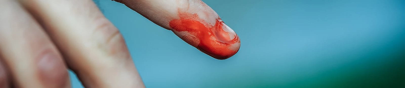 Tangan yang terluka harus segera disembuhkan