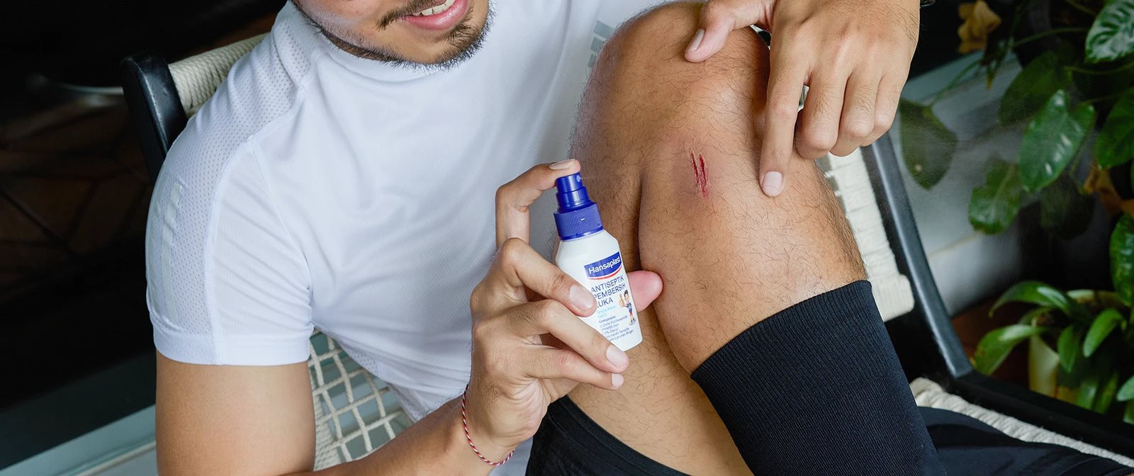 Cara menyembuhkan luka lecet di kaki setelah terjatuh.