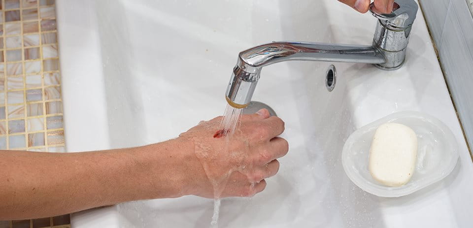 Agua del grifo y heridas
