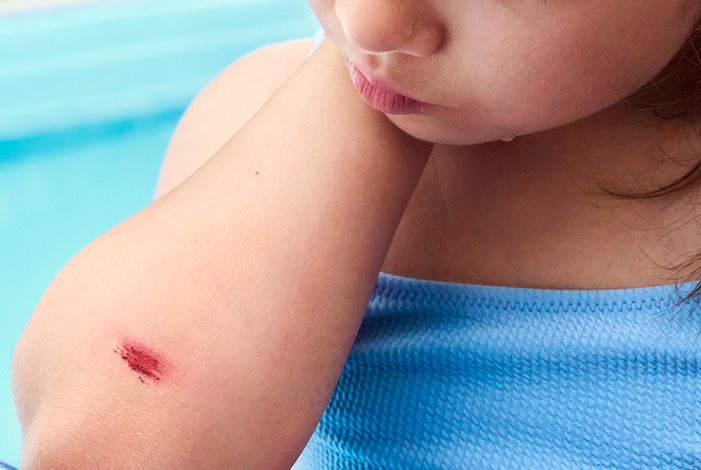 Detailansicht einer Person, die ein Pflaster auf den Zeigefinger klebt.