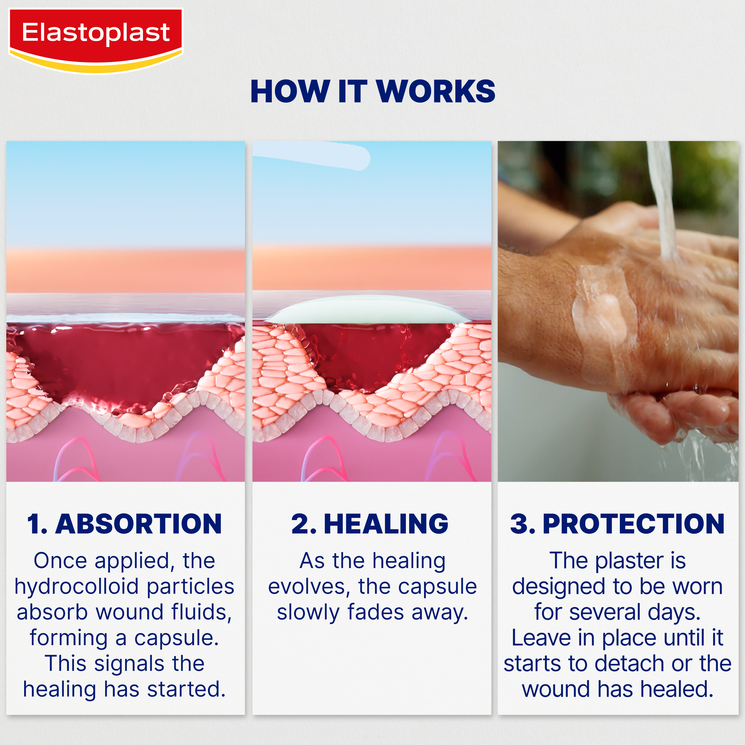 Three steps of how hydrocolloid plasters work to heal the wound