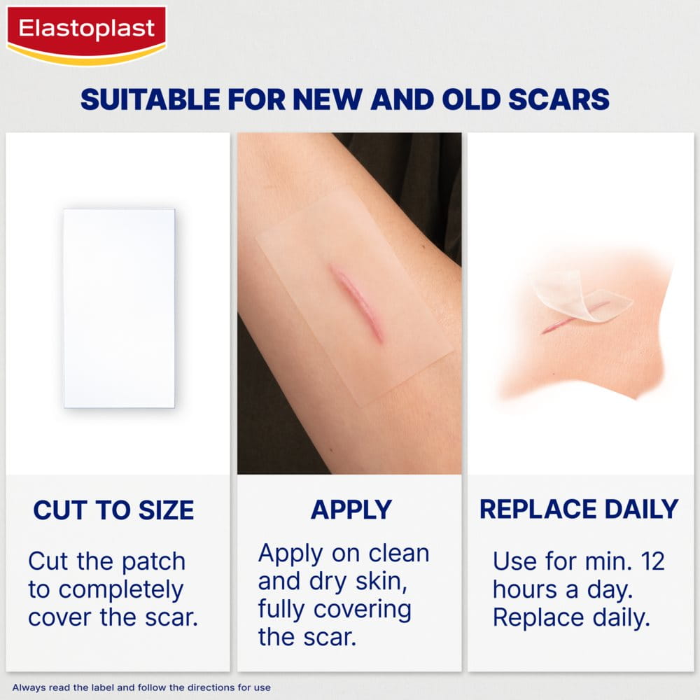 Scar hot sale treatment patches