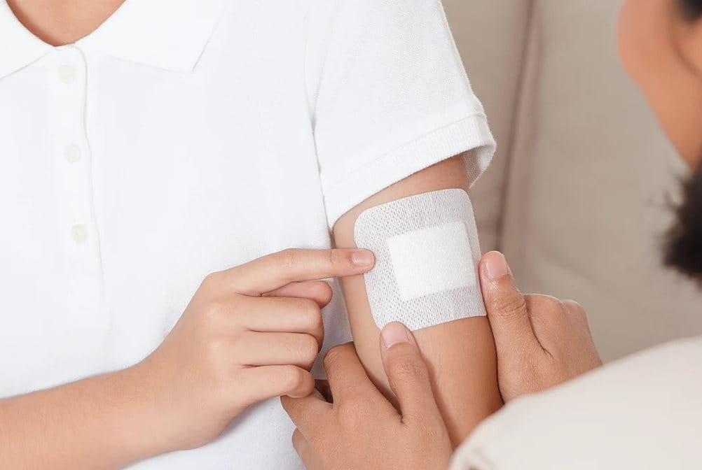 Cara merawat luka operasi agar cepat kering di rumah.