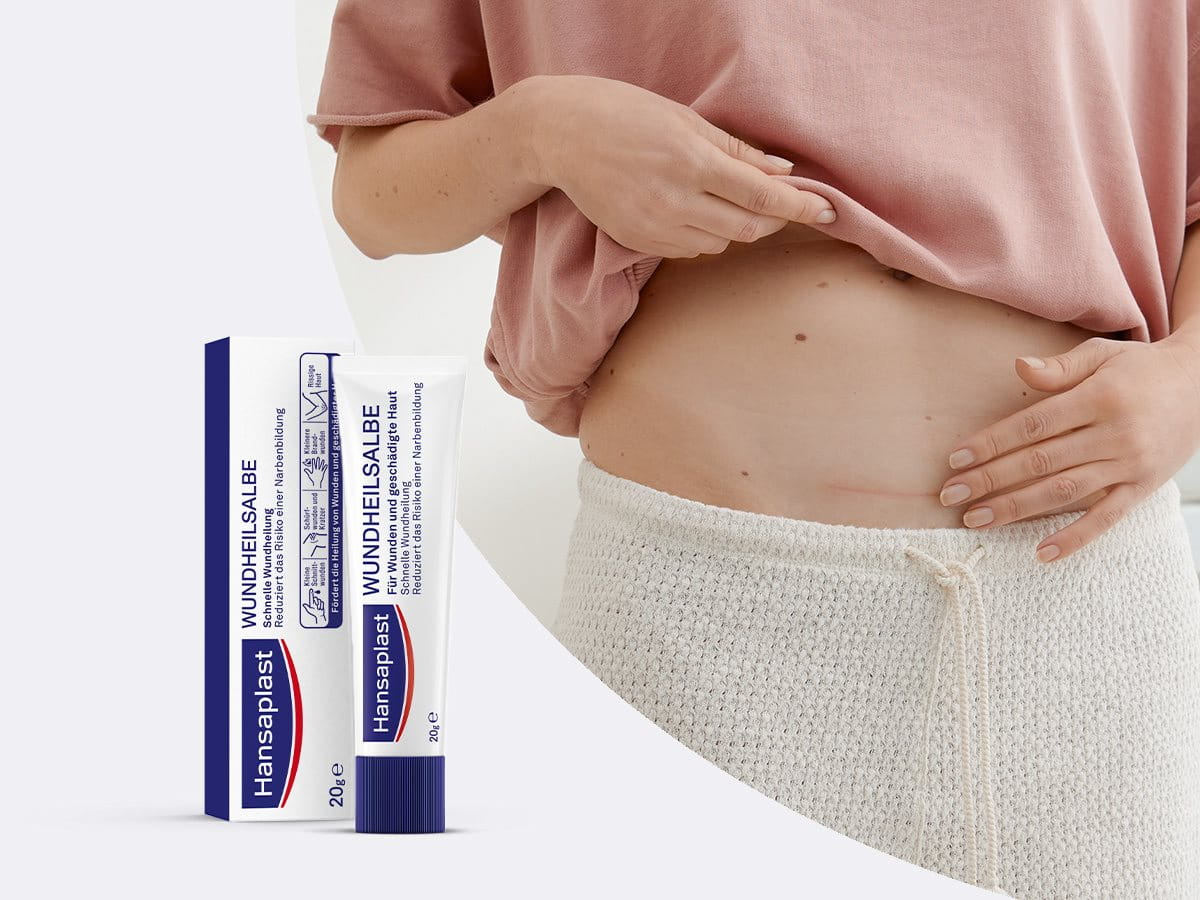 Hansaplast Wundheilsalbe wird auf Wunde am Knie aufgetragen